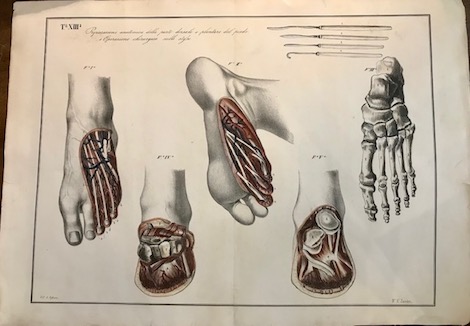 Sandri Antonio Tavola XIII. Preparazione anatomica della parte dorsale e plantare del piede, e Operazione chirurgica sullo stesso 1854 Brescia 